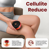 Becommend Smart Dynamic Cupping Therapy Set,Cellulite Massager 4 in 1 Vacuum Therapy Machine Cellulite Remover,Gua Sha Massage Tool with12 Level Temperature and Suction, 12 Level Red